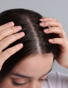 Scalp Treatment High Wycombe Scalp Treatment High Wycombe